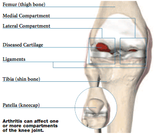 Anatomical Knee Joint Key Ring Keychain Femur Tibia 